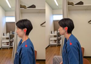 いい姿勢とフォワードヘッドポスチャーの比較画像