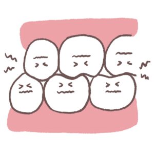 くいしばり